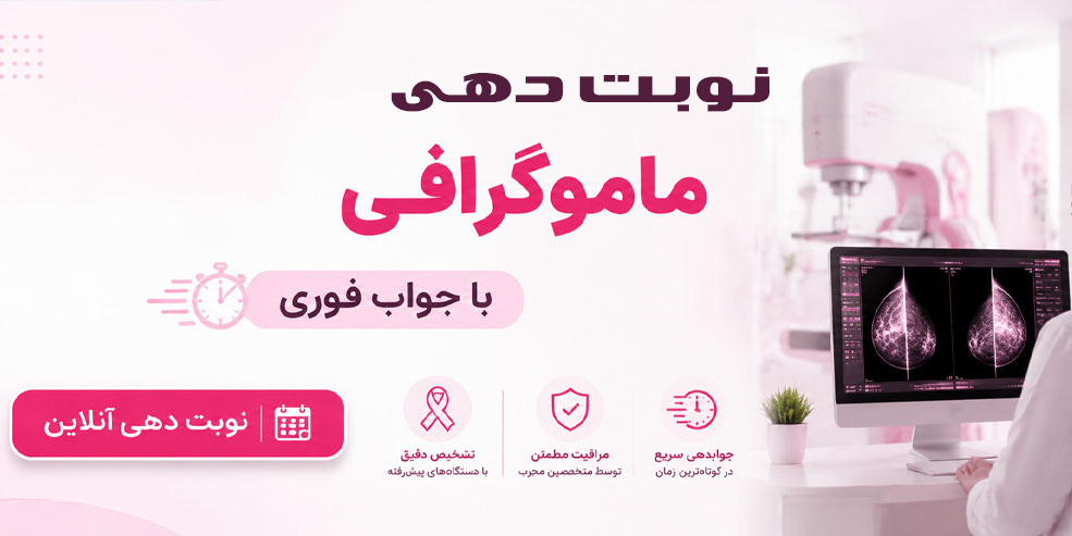 نوبت دهی ماموگرافی