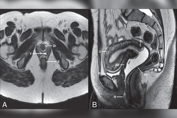 نوبت دهی | ام آر آی ستون فقرات و اطلاعات درباره آن