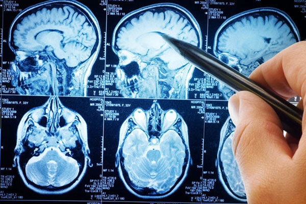 نوبت دهی درباره ام آر آی مغز