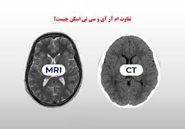 تفاوت MRI و CT چیست؟